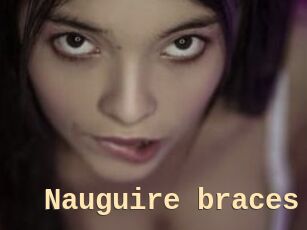 Nauguire_braces